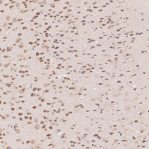 G3BP1 Rabbit Polyclonal Antibody