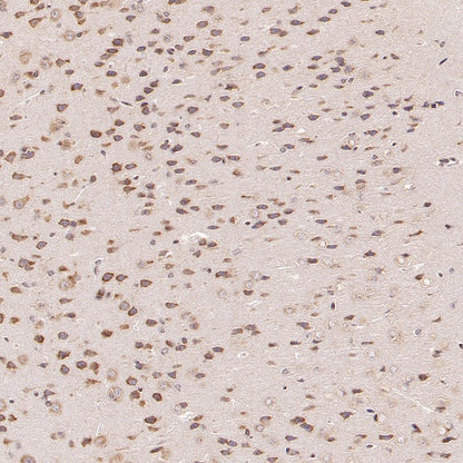 G3BP1 Rabbit Polyclonal Antibody