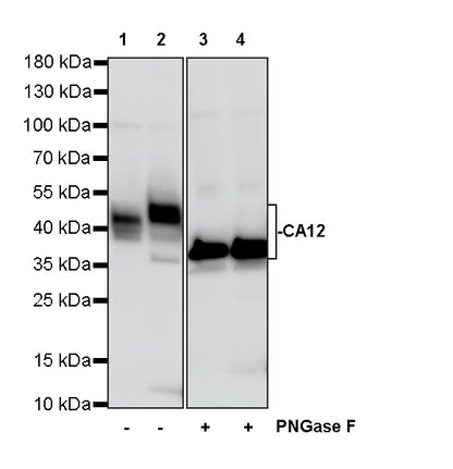 CA12 Rabbit Polyclonal Antibody