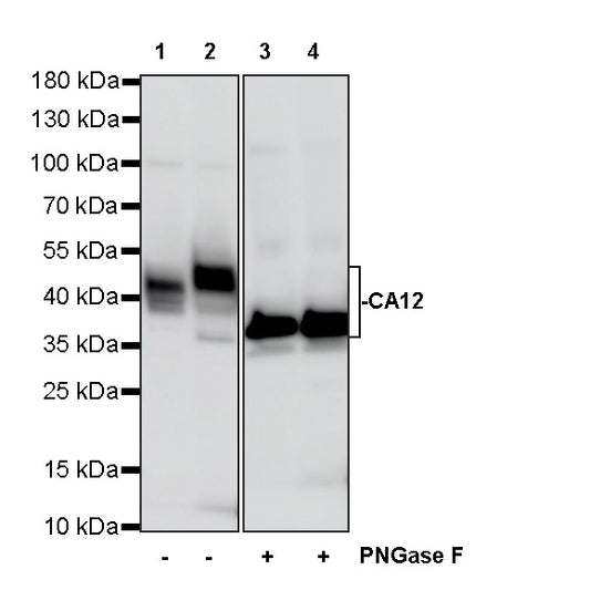 CA12 Rabbit Polyclonal Antibody