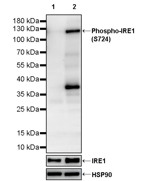 Phospho-IRE1 (S724) Recombinant Rabbit mAb (S-3480-15)