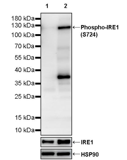 Phospho-IRE1 (S724) Recombinant Rabbit mAb (S-3480-15)