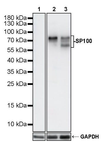 SP100 Rabbit Polyclonal Antibody