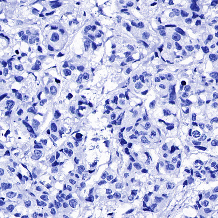 TSH Receptor/TSH-R Recombinant Rabbit mAb (S-5699)