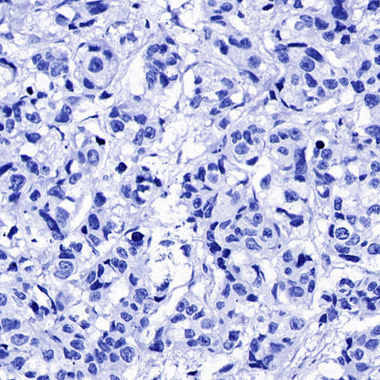 TSH Receptor/TSH-R Recombinant Rabbit mAb (S-5699)