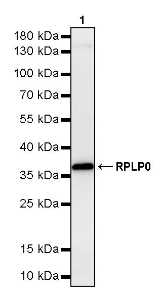 RPLP0 Rabbit Polyclonal Antibody