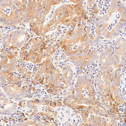 LPCAT1 Recombinant Rabbit mAb (S-6053)
