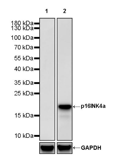 p16INK4a Recombinant Rabbit mAb (S-2573-6)