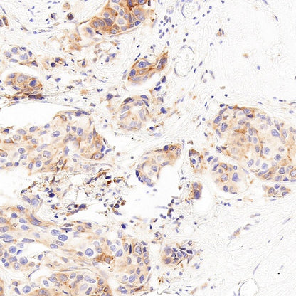 LPCAT1 Recombinant Rabbit mAb (S-6053)