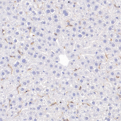 CSF-1R Rabbit Polyclonal Antibody