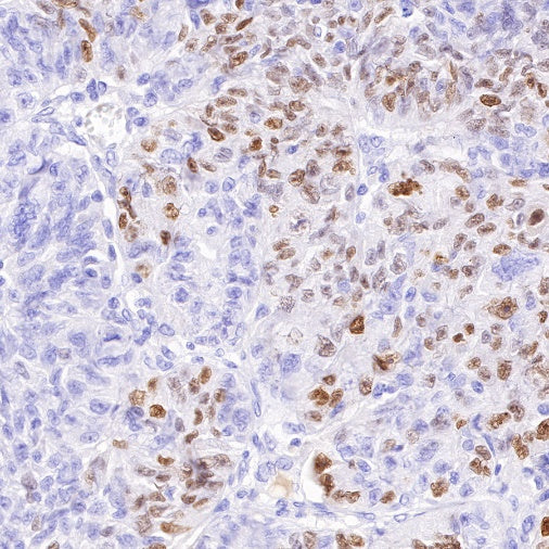SAGE1 Recombinant Rabbit mAb (SDT-317-60)