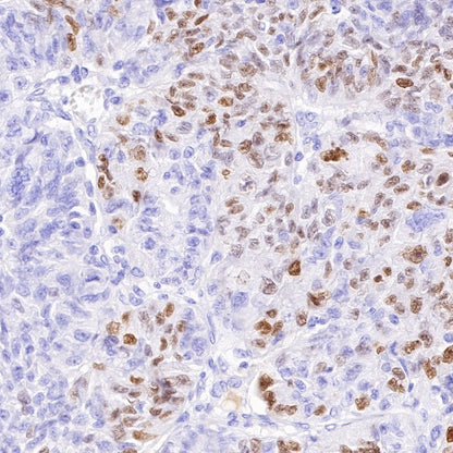 SAGE1 Recombinant Rabbit mAb (SDT-317-60)