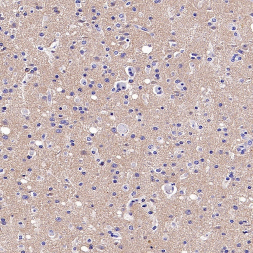 BACE1 Recombinant Rabbit mAb (S-2514-34)