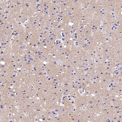 BACE1 Recombinant Rabbit mAb (S-2514-34)