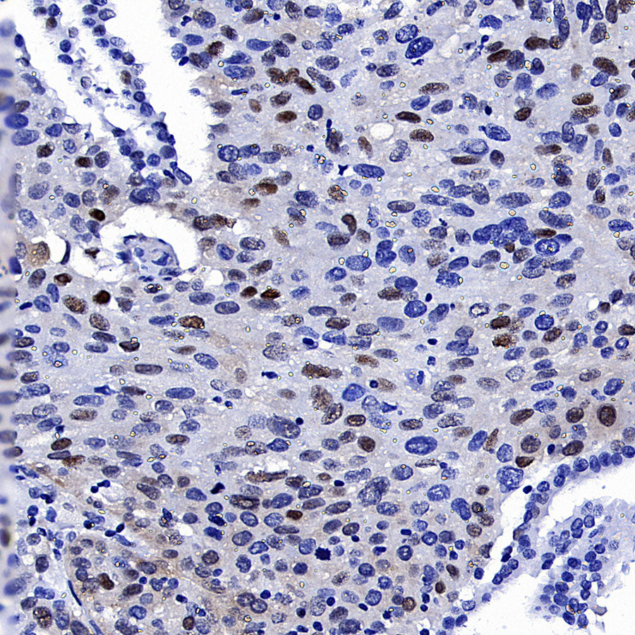 Cyclin E1 Recombinant Rabbit mAb (SDT-4375-44)