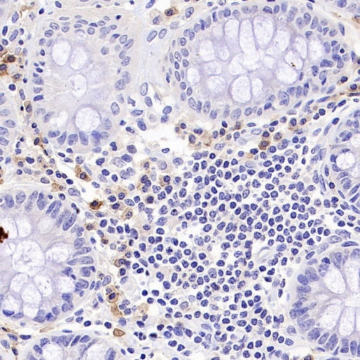 TNFRSF17/BCMA Recombinant Rabbit mAb (S-4674)