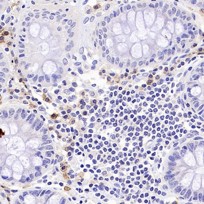 TNFRSF17/BCMA Recombinant Rabbit mAb (S-4674)