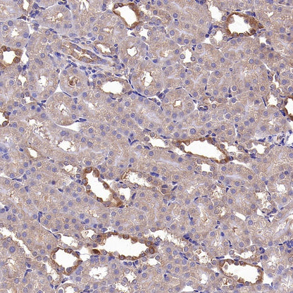 TSG101 Recombinant Rabbit mAb (S-1868-76)