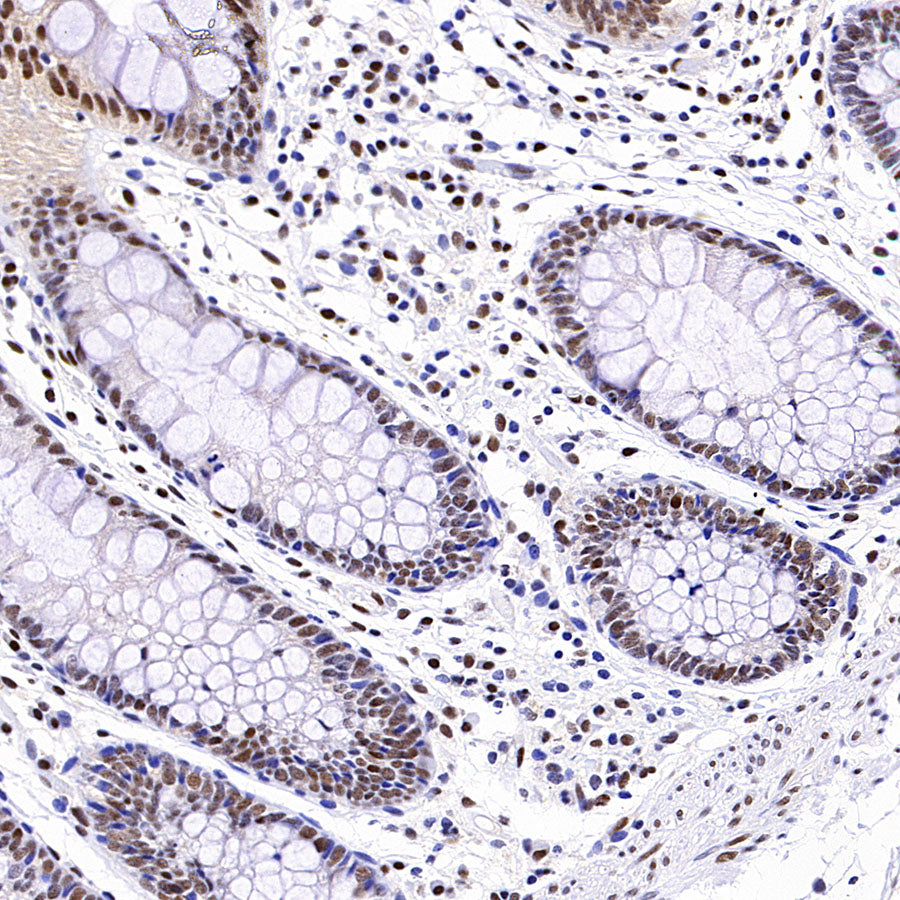 PAPSS1 Recombinant Rabbit mAb (S-3516-23)
