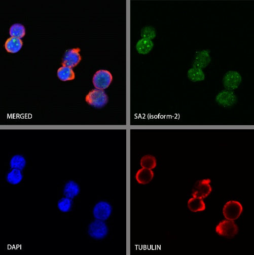 SA2 (isoform-2) Recombinant Rabbit mAb (S-1461-231)