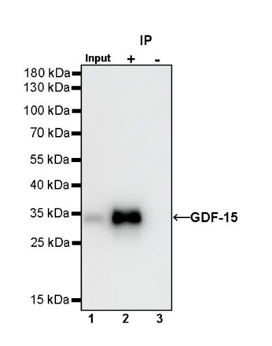GDF-15 Recombinant Rabbit mAb (S-1012-42)