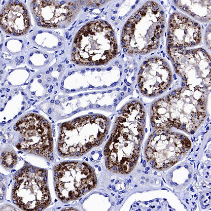 FGF Receptor 1 Recombinant Rabbit mAb (S-5668)