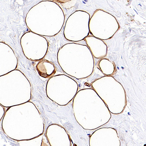 FABP4 Recombinant Rabbit mAb (S-1360-168)