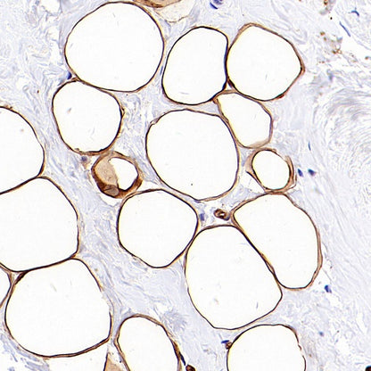 FABP4 Recombinant Rabbit mAb (S-1360-168)