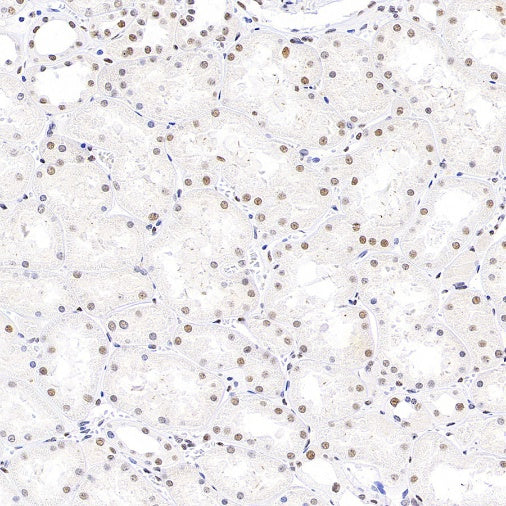 SP100 Rabbit Polyclonal Antibody