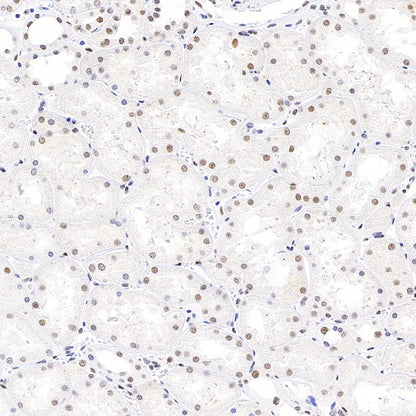 SP100 Rabbit Polyclonal Antibody