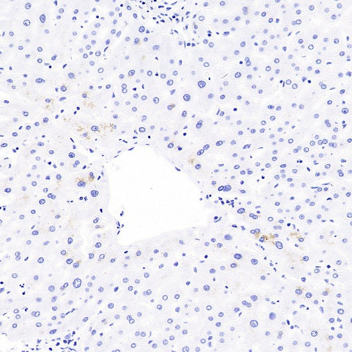 KLK2 Recombinant Rabbit mAb (SDT-4461-19)
