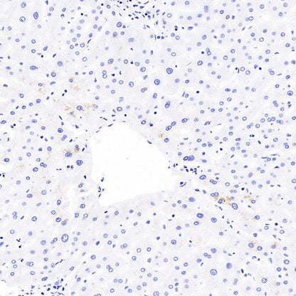 KLK2 Recombinant Rabbit mAb (SDT-4461-19)
