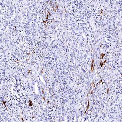 Calretinin Recombinant Rabbit mAb (SDT-2773-21)