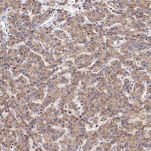 CHMP1a Recombinant Rabbit mAb (S-1651-159)