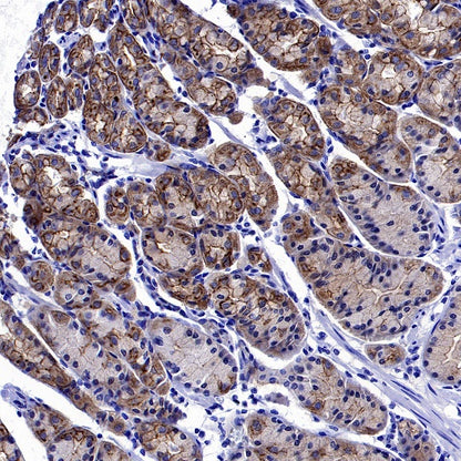 Cortactin Recombinant Rabbit mAb (S-1303-10)