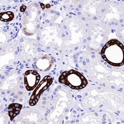 MUC4 Recombinant Rabbit mAb (SDT-R228)