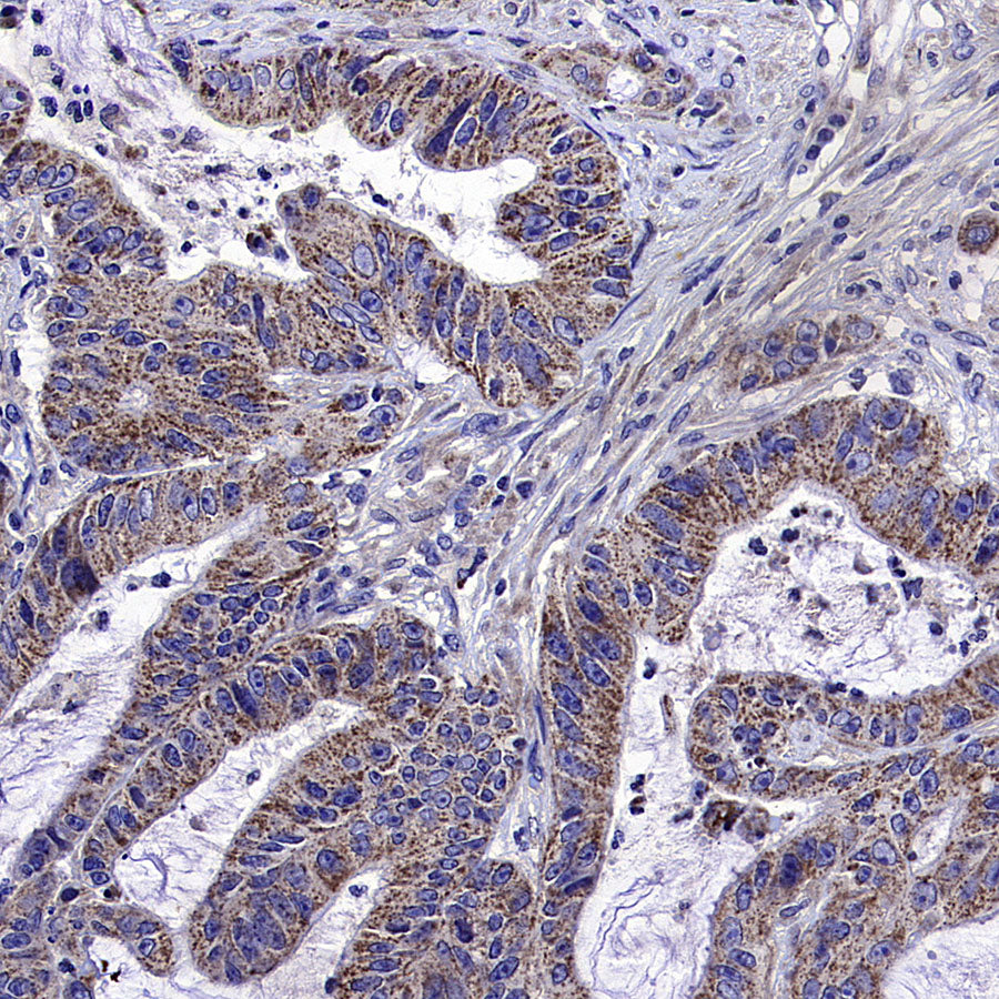 ALDH2 Rabbit Polyclonal Antibody