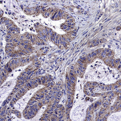 ALDH2 Rabbit Polyclonal Antibody