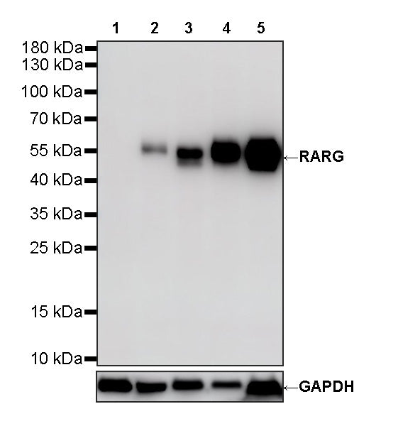 RARG Recombinant Rabbit mAb (S-4448-23)