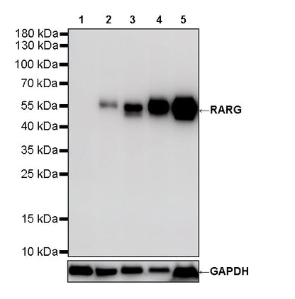 RARG Recombinant Rabbit mAb (S-4448-23)