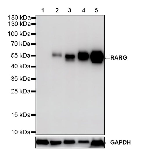 RARG Recombinant Rabbit mAb (S-4448-23)