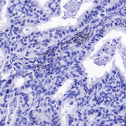 CD137 Recombinant Rabbit mAb (S-1726-175)
