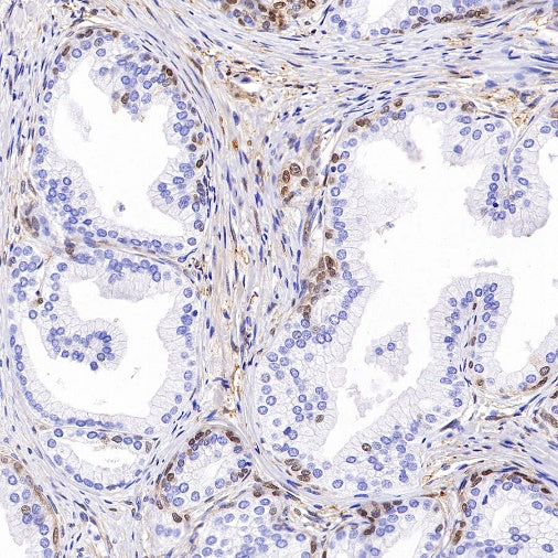 QPRT Recombinant Rabbit mAb (S-1228-31)