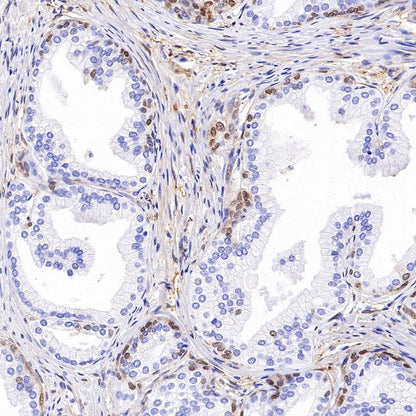 QPRT Recombinant Rabbit mAb (S-1228-31)