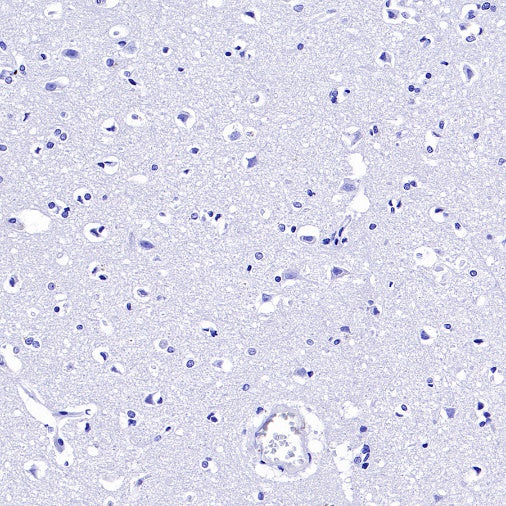 BANK1 Recombinant Rabbit mAb, PBS Only (SDT-2265-37)