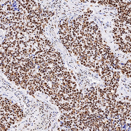 Nucleolin Rabbit Polyclonal Antibody