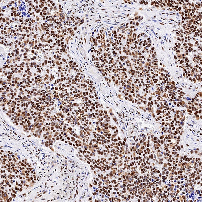 Nucleolin Rabbit Polyclonal Antibody
