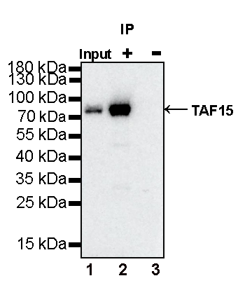 TAF15 Recombinant Rabbit mAb (S-1508-53)