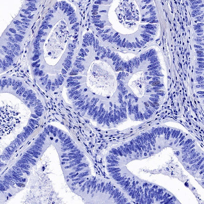 CD56 Recombinant Rabbit mAb (SDT-5000)