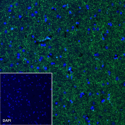 Myelin Oligodendrocyte Glycoprotein (MOG) Recombinant Rabbit mAb (S-1384-61)